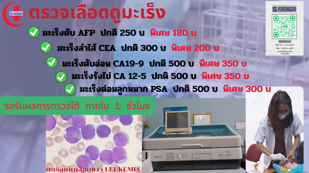 ตรวจเลือดดูมะเร็ง